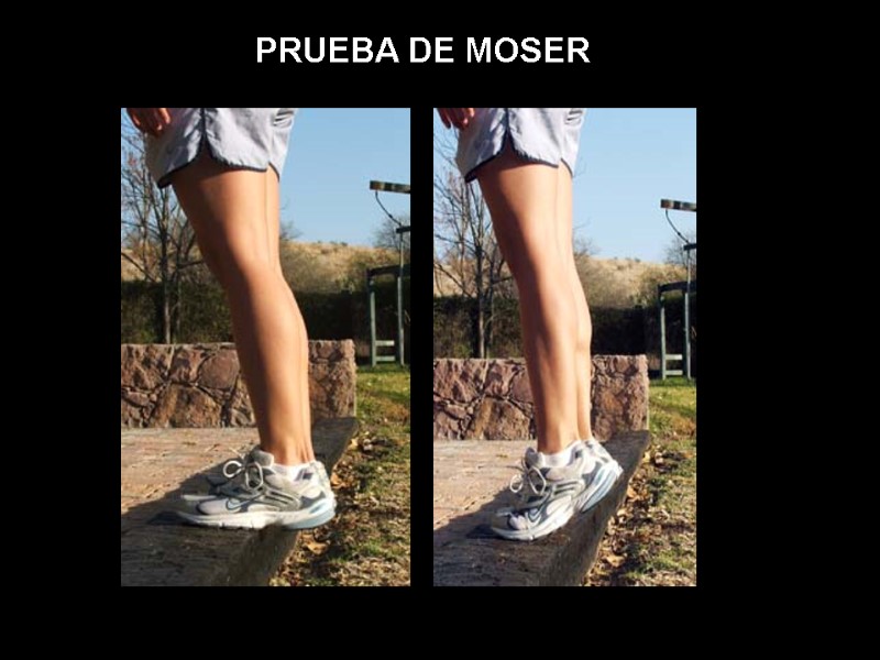 PRUEBA DE MOSER